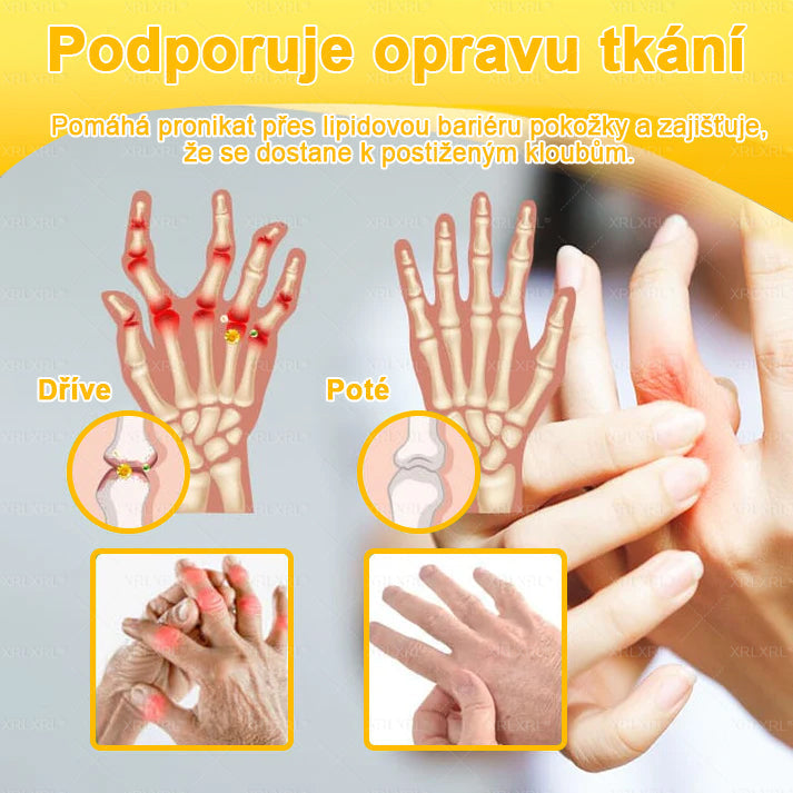 👩‍⚕️👩‍⚕️XRLXRL® prémiový regenerační krém na klouby a kosti– úleva od bolesti kloubů a kostí, vhodné pro dospělé a seniory