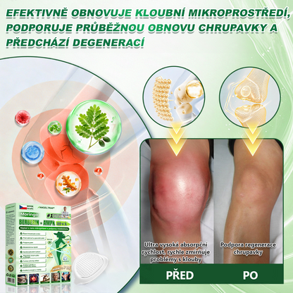 🍀🛡️ Oficiální vlajkový obchod | 💜💜 𝑨𝑵𝑮𝑬𝑳𝑻𝑹𝑨𝑷® Moringa × berberin × AMPK 10 v 1 — nanomikrojehličkové náplasti na podporu hubnutí 🇨🇿 Stačí 1× denně ✅ Výsledky již za 7 dní — podpora při nadváze, pro zdraví srdce a cév a péči o klouby
