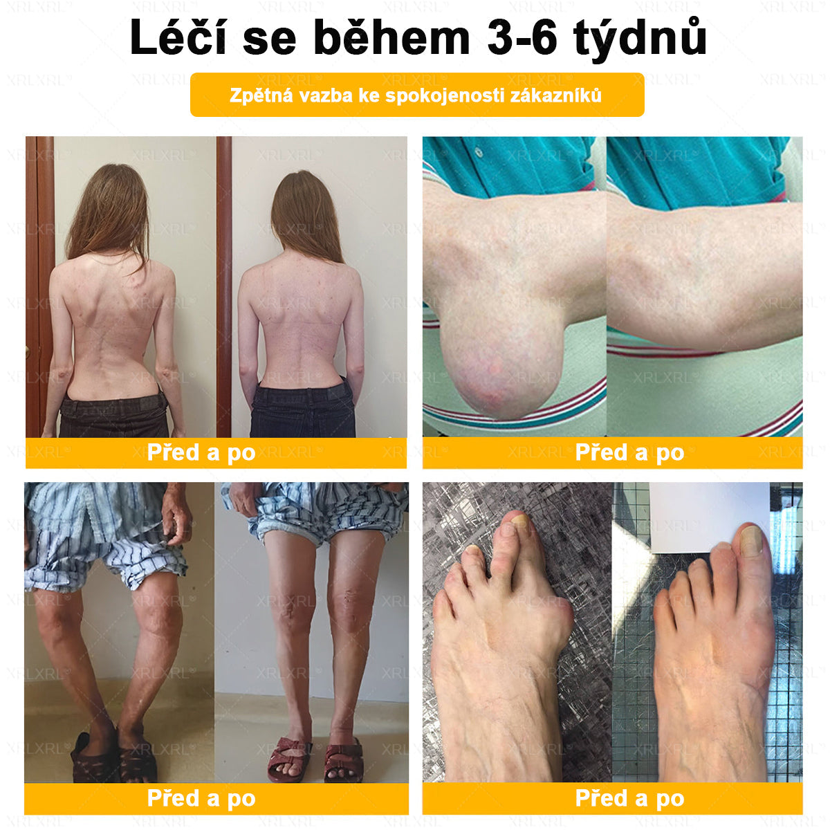 👩‍⚕️👩‍⚕️XRLXRL® prémiový regenerační krém na klouby a kosti– úleva od bolesti kloubů a kostí, vhodné pro dospělé a seniory