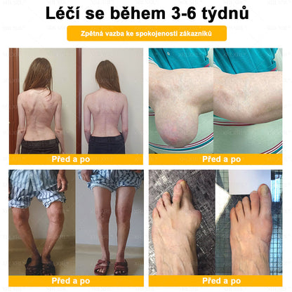 👩‍⚕️👩‍⚕️XRLXRL® prémiový regenerační krém na klouby a kosti– úleva od bolesti kloubů a kostí, vhodné pro dospělé a seniory
