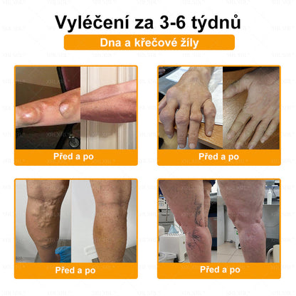 👩‍⚕️👩‍⚕️XRLXRL® prémiový regenerační krém na klouby a kosti– úleva od bolesti kloubů a kostí, vhodné pro dospělé a seniory