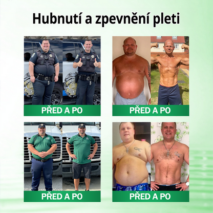 🍀🛡️ Oficiální vlajkový obchod | 💜💜 𝑨𝑵𝑮𝑬𝑳𝑻𝑹𝑨𝑷® Moringa × berberin × AMPK 10 v 1 — nanomikrojehličkové náplasti na podporu hubnutí 🇨🇿 Stačí 1× denně ✅ Výsledky již za 7 dní — podpora při nadváze, pro zdraví srdce a cév a péči o klouby