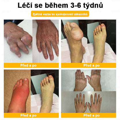 👩‍⚕️👩‍⚕️XRLXRL® prémiový regenerační krém na klouby a kosti– úleva od bolesti kloubů a kostí, vhodné pro dospělé a seniory
