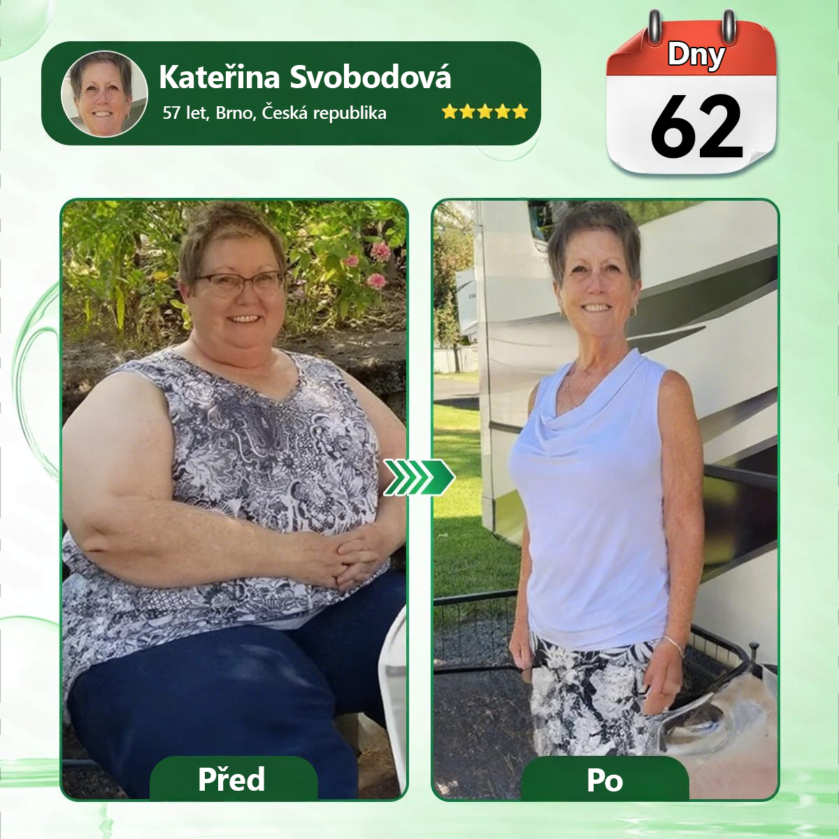 🍀🛡️ Oficiální vlajkový obchod | 💜💜 𝑨𝑵𝑮𝑬𝑳𝑻𝑹𝑨𝑷® Moringa × berberin × AMPK 10 v 1 — nanomikrojehličkové náplasti na podporu hubnutí 🇨🇿 Stačí 1× denně ✅ Výsledky již za 7 dní — podpora při nadváze, pro zdraví srdce a cév a péči o klouby