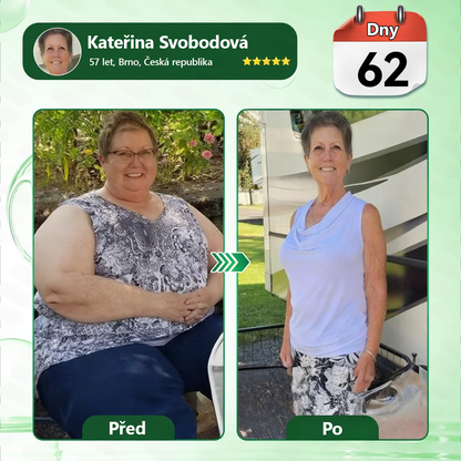 🍀🛡️ Oficiální vlajkový obchod | 💜💜 𝑨𝑵𝑮𝑬𝑳𝑻𝑹𝑨𝑷® Moringa × berberin × AMPK 10 v 1 — nanomikrojehličkové náplasti na podporu hubnutí 🇨🇿 Stačí 1× denně ✅ Výsledky již za 7 dní — podpora při nadváze, pro zdraví srdce a cév a péči o klouby