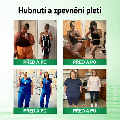 🍀🛡️ Oficiální vlajkový obchod | 💜💜 𝑨𝑵𝑮𝑬𝑳𝑻𝑹𝑨𝑷® Moringa × berberin × AMPK 10 v 1 — nanomikrojehličkové náplasti na podporu hubnutí 🇨🇿 Stačí 1× denně ✅ Výsledky již za 7 dní — podpora při nadváze, pro zdraví srdce a cév a péči o klouby