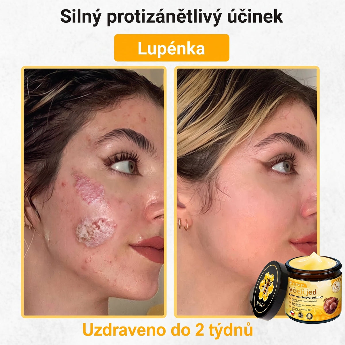 👩‍⚕️👩‍⚕️👩‍⚕️👩‍⚕️ VLSVLS® Krém se včelím jedem | 50 ml | Profesionální složení pro péči a regeneraci pokožky