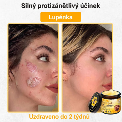 👩‍⚕️👩‍⚕️👩‍⚕️👩‍⚕️ VLSVLS® Krém se včelím jedem | 50 ml | Profesionální složení pro péči a regeneraci pokožky