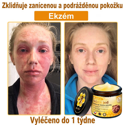👩‍⚕️👩‍⚕️👩‍⚕️👩‍⚕️ VLSVLS® Krém se včelím jedem | 50 ml | Profesionální složení pro péči a regeneraci pokožky
