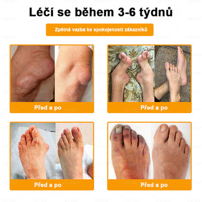 👩‍⚕️👩‍⚕️XRLXRL® prémiový regenerační krém na klouby a kosti– úleva od bolesti kloubů a kostí, vhodné pro dospělé a seniory