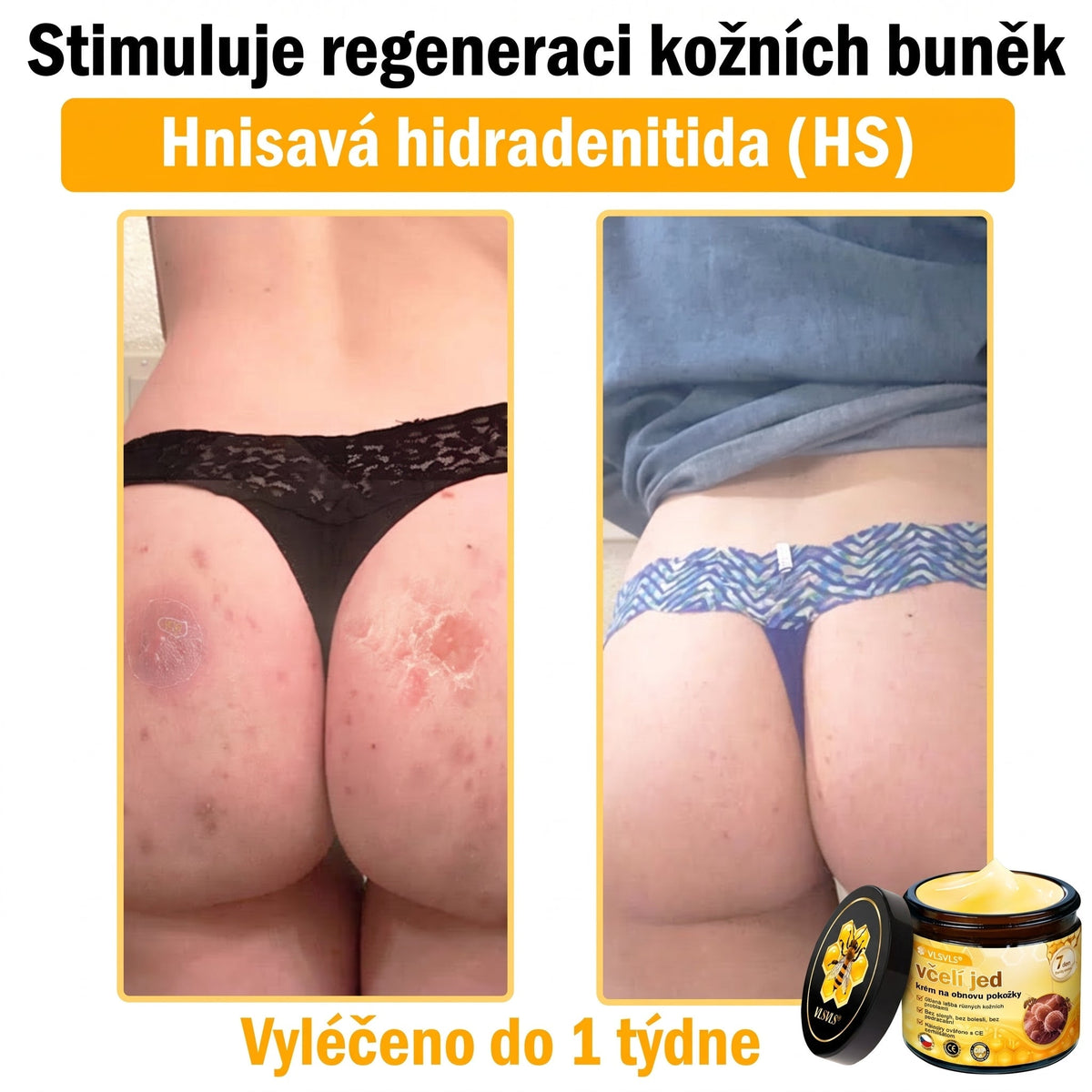 👩‍⚕️👩‍⚕️👩‍⚕️👩‍⚕️ VLSVLS® Krém se včelím jedem | 50 ml | Profesionální složení pro péči a regeneraci pokožky