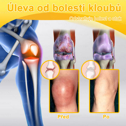 👩‍⚕️👩‍⚕️XRLXRL® prémiový regenerační krém na klouby a kosti– úleva od bolesti kloubů a kostí, vhodné pro dospělé a seniory