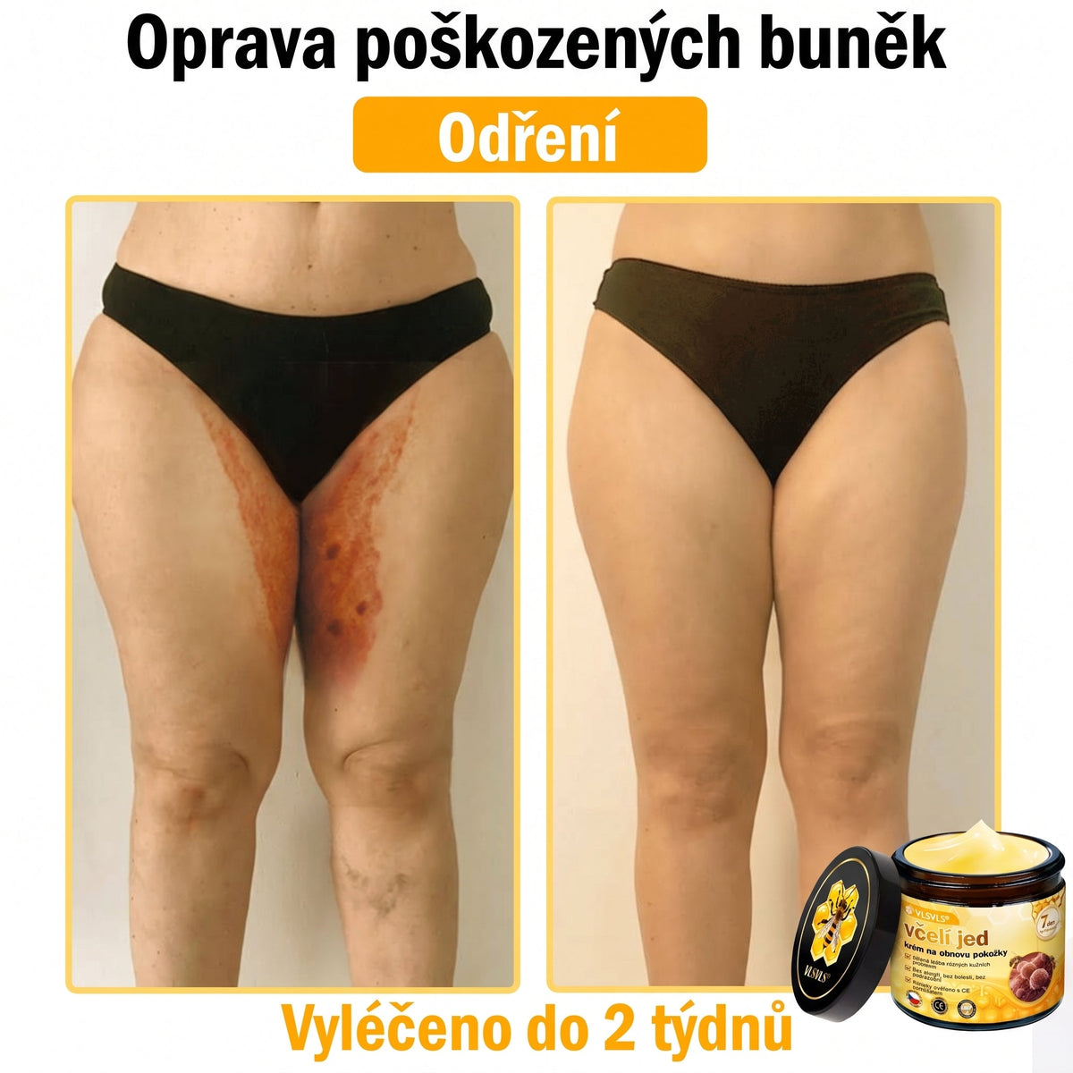 👩‍⚕️👩‍⚕️👩‍⚕️👩‍⚕️ VLSVLS® Krém se včelím jedem | 50 ml | Profesionální složení pro péči a regeneraci pokožky