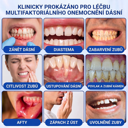 🇨🇿) 🦷 𝐀𝐍𝐆𝐄𝐋𝐓𝐑𝐀𝐏®  𝐎𝐛𝐧𝐨𝐯𝐚 𝐝á𝐬𝐧í 𝐩𝐚𝐫𝐨𝐝𝐨𝐧𝐭á𝐥𝐧í 𝐨𝐩𝐫𝐚𝐯𝐧ý 𝐠𝐞🏷️