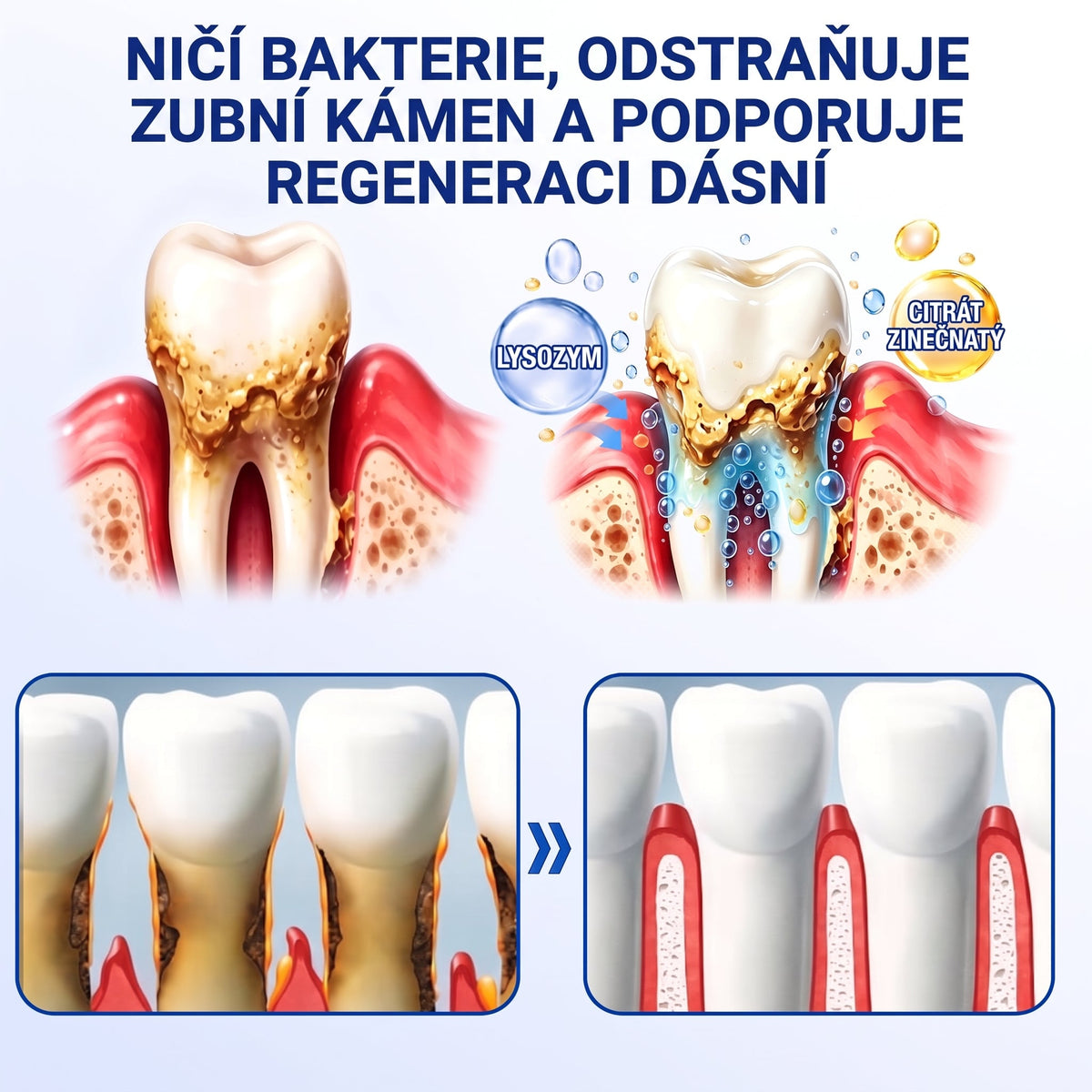 🇨🇿) 🦷 𝐀𝐍𝐆𝐄𝐋𝐓𝐑𝐀𝐏®  𝐎𝐛𝐧𝐨𝐯𝐚 𝐝á𝐬𝐧í 𝐩𝐚𝐫𝐨𝐝𝐨𝐧𝐭á𝐥𝐧í 𝐨𝐩𝐫𝐚𝐯𝐧ý 𝐠𝐞🏷️