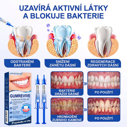 🇨🇿) 🦷 𝐀𝐍𝐆𝐄𝐋𝐓𝐑𝐀𝐏®  𝐎𝐛𝐧𝐨𝐯𝐚 𝐝á𝐬𝐧í 𝐩𝐚𝐫𝐨𝐝𝐨𝐧𝐭á𝐥𝐧í 𝐨𝐩𝐫𝐚𝐯𝐧ý 𝐠𝐞🏷️